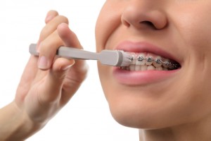 spazzolino da denti per apparecchio ortodontico